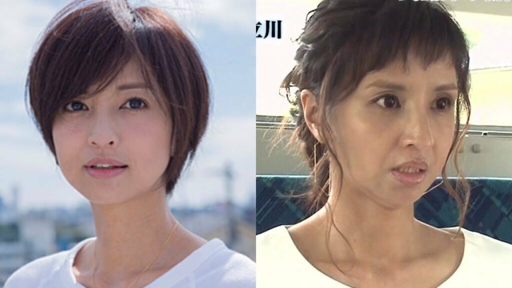 劣化しすぎ！！あの芸能人が・・・信じられない！【ビフォーアフター画像】