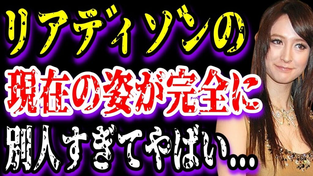 【ゆっくり解説】リアディゾンの現在の姿が完全に別人すぎてやばい...