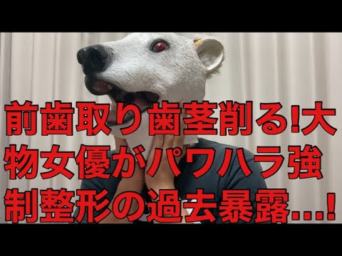 女優広田レオナがデビュー時のパワハラ暴露!前歯を取り歯茎を削り強制整形された過去…!