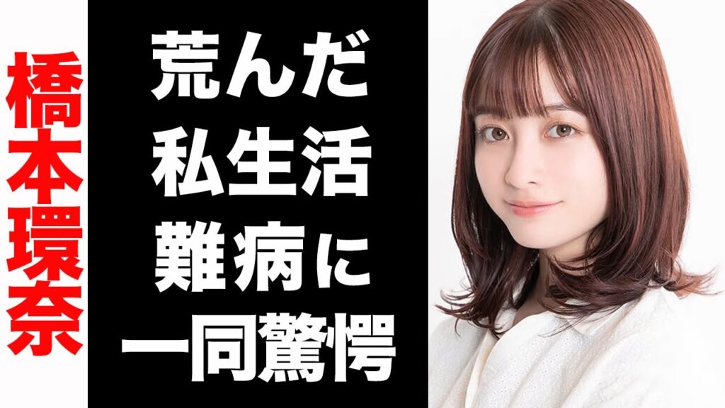 橋本環奈の抱える難病がヤバい...！荒んだ私生活が衝撃的すぎた...！