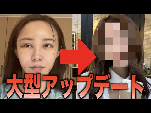 【大型整形】遂に新しい顔と整形内容を公開