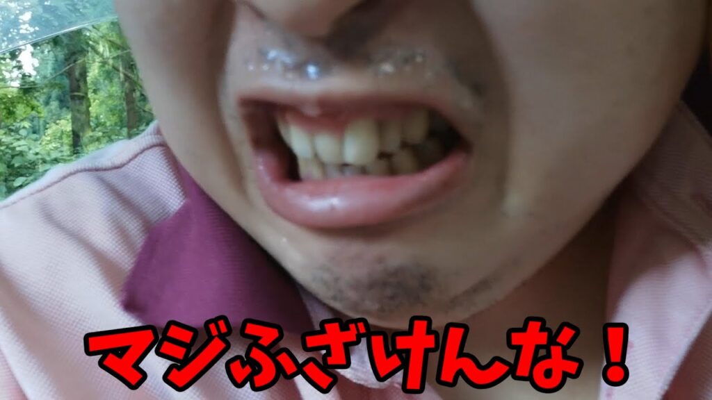 ちょんまげ小僧、フィッシャーズコラボ！マジふざけんな！！！！