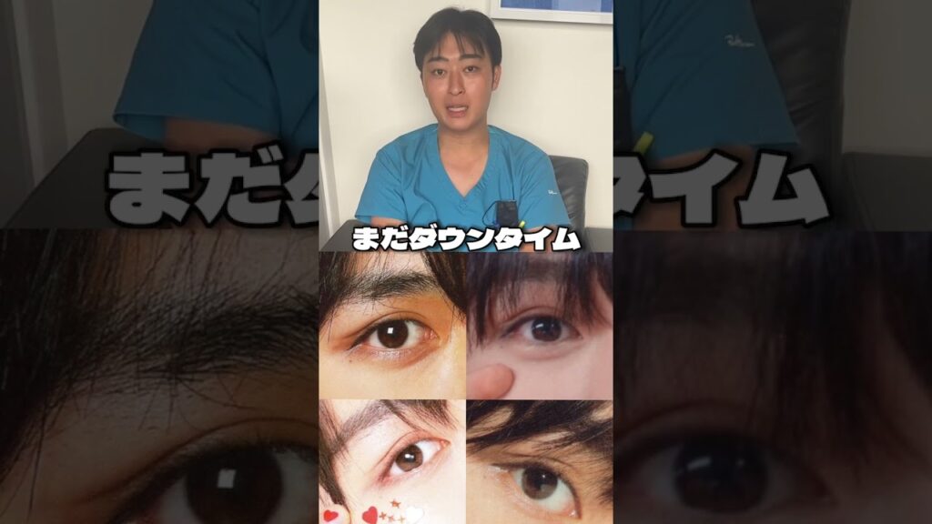 #なにわ男子 #大西流星 #二重整形