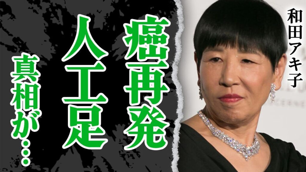和田アキ子が退院したものの人工足の真相に絶句！入院後の生活や新しい学校のリーダーズとの共演でうまく歌えなかった本当の理由に驚きを隠せない！【芸能】