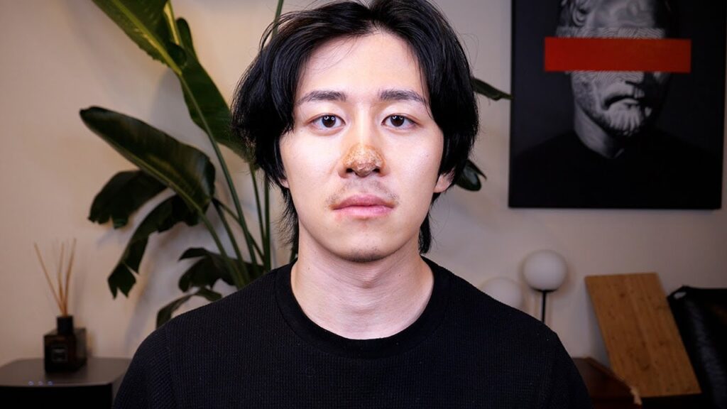 2度目の鼻整形したので正直に話します