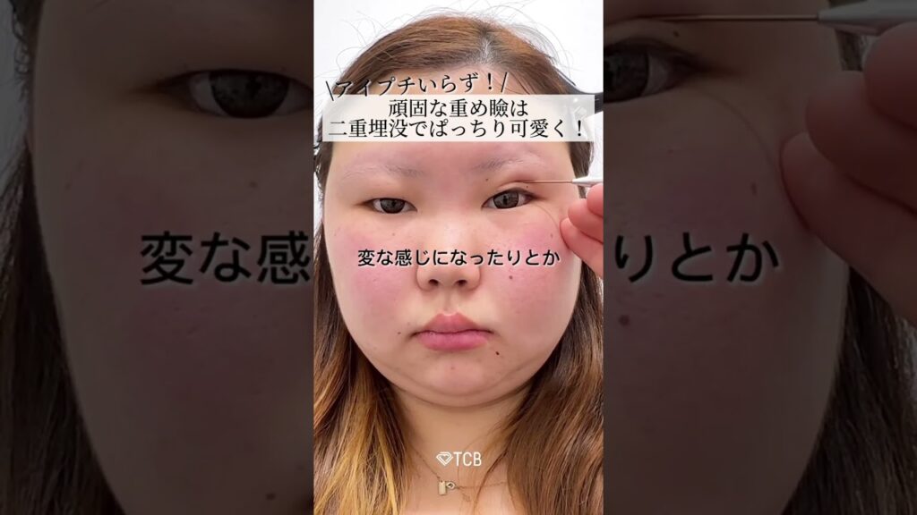 【二重整形】頑固な重め瞼二重幅デザイン解説👀❤️#shorts
