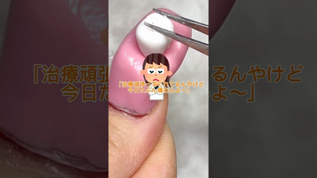 むし歯治療をネイルでしてみた🦷🦷#ネイル #ネイルデザイン #おかば #ジェル #tiktok #歯医者 #虫歯 #日常 #ジェルネイル #shortvideo むし歯治療をネイルでしてみた🦷🦷#ネイル #ネイルデザイン #おかば #ジェル #tiktok #歯医者 #虫歯 #日常 #ジェルネイル #shortvideo