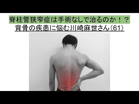 背骨の疾患に苦しむ川崎麻世さんの実話!治療と克服の方法とは? 背骨の疾患に苦しむ川崎麻世さんの実話!治療と克服の方法とは?