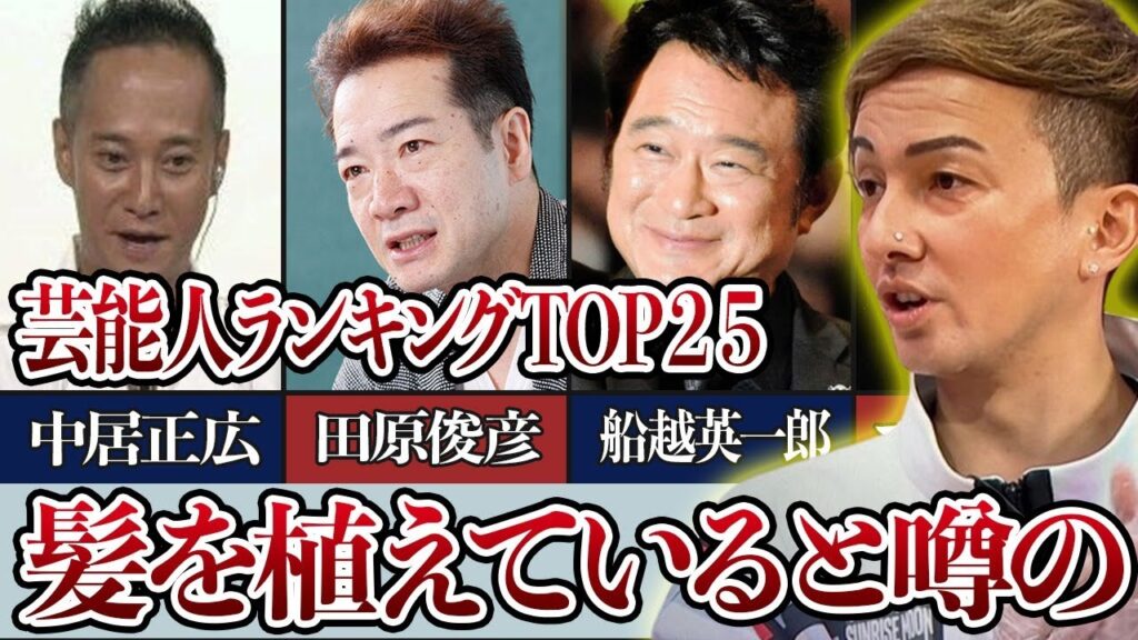 植毛したと噂の芸能人衝撃ランキングTOP２５！