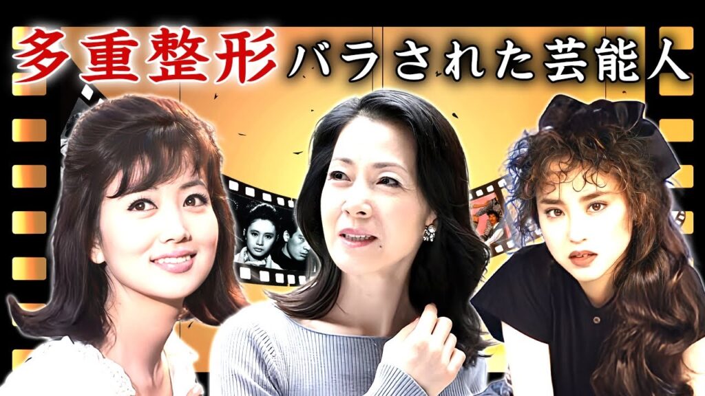 多重整形で激変した女性芸能人・有名人２０選【※医師が衝撃暴露】