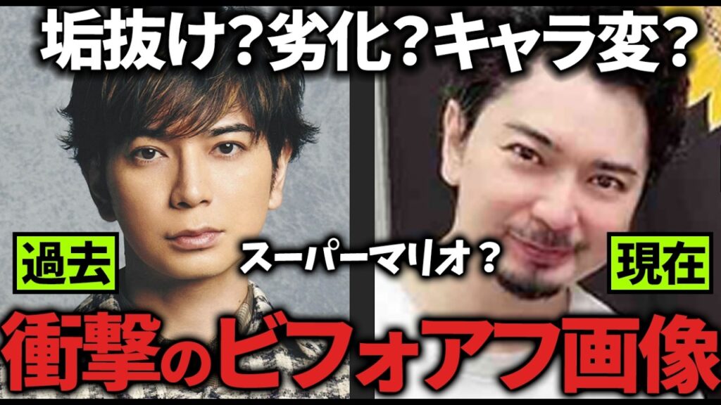 【ガルちゃん】整形?劣化?変わりすぎてビビった…芸能人の衝撃ビフォアフ画像教えてw【ガルちゃん】 【ガルちゃん】整形?劣化?変わりすぎてビビった…芸能人の衝撃ビフォアフ画像教えてw【ガルちゃん】