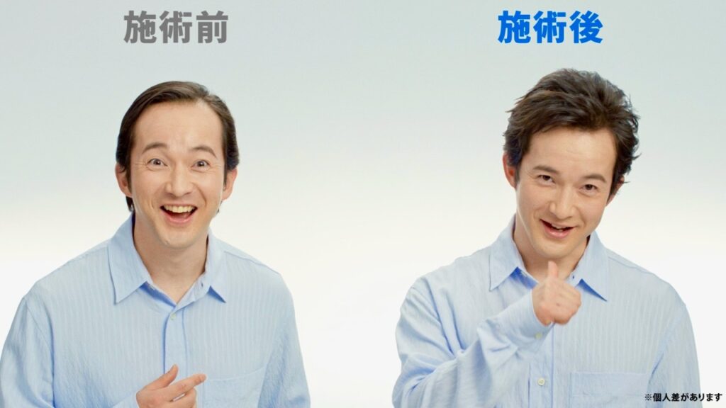 浅利陽介37歳、増毛ビフォーアフターに感激！引っ張って感動！渡部篤郎がプレゼンター／アートネイチャーCM＋インタビュー＋メイキング