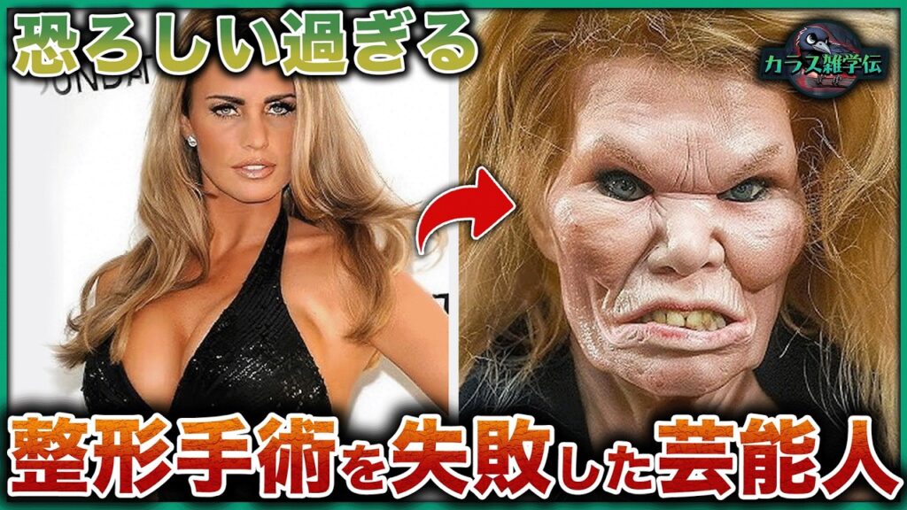 【衝撃】世界最悪の芸能人整形失敗10選!手術ミスで”顔面カオス”の恐怖!1位は人型怪物レベルでファンが失神した衝撃映像! 【衝撃】世界最悪の芸能人整形失敗10選!手術ミスで"顔面カオス"の恐怖!1位は人型怪物レベルでファンが失神した衝撃映像!