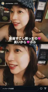竹内涼真の妹・ほのか「前歯すこし削ったの」治療後の“最新スマイル”公開　悩み告白「長いから」 - スポニチ Sponichi Annex 芸能