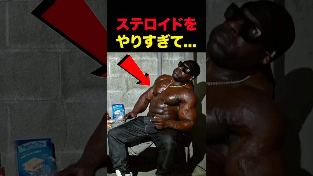 ステロイド中毒の末路… #shorts