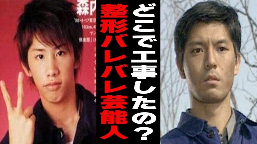 【ガルちゃん芸能人】どこでやったの？ｗ整形してる男性芸能人Part3