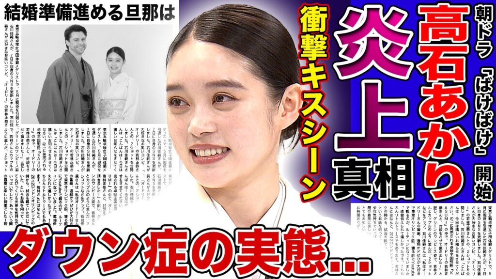 【衝撃】高石あかり「ばけばけ」初回から炎上…衝撃のキスシーンの裏で囁かれる本性に言葉を失う!朝ドラ女優となった彼女の和田雅成との結婚準備の真相…ダウン症・整形依存の実態に驚きを隠せない! 【衝撃】高石あかり「ばけばけ」初回から炎上…衝撃のキスシーンの裏で囁かれる本性に言葉を失う!朝ドラ女優となった彼女の和田雅成との結婚準備の真相…ダウン症・整形依存の実態に驚きを隠せない!