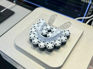 見えない「矯正力」を可視化…韓国発・次世代の歯科センサー　写真枚　国際ニュース：AFPBB News