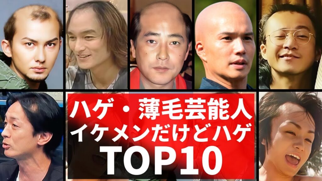 イケメンだが…実はハゲ・薄毛を噂されている男性芸能人TOP10