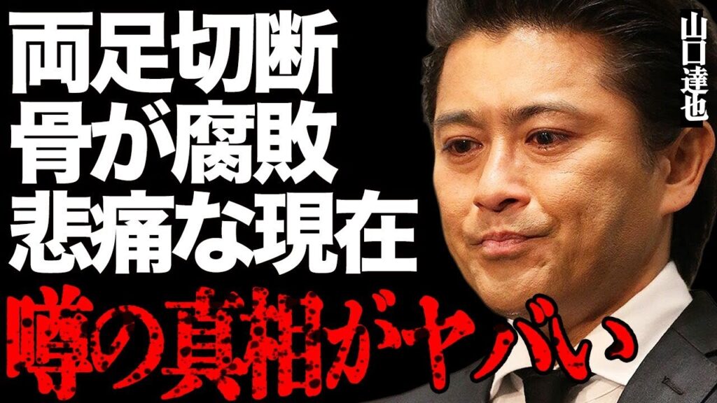 元TOKIO・山口達也が難病で骨が腐り両足切断した真相がヤバい…アルコール依存症が完治せずにもがき苦しむ悲痛な現在に言葉を失う…