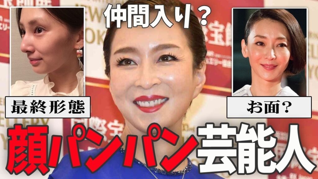 【ガルちゃん芸能】美容医療やりすぎ芸能人・有名人【有益2ch】 2