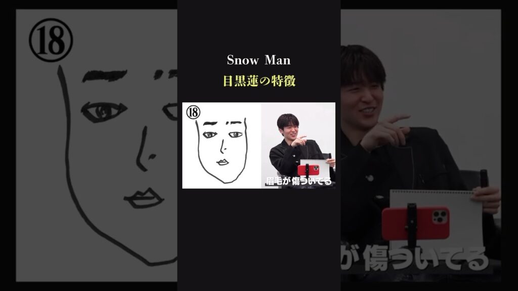 【努力】SnowMan 目黒蓮の顔にキズ その理由は? 【努力】SnowMan 目黒蓮の顔にキズ その理由は?